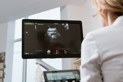 OB/GYN looking at a sonogram on screen